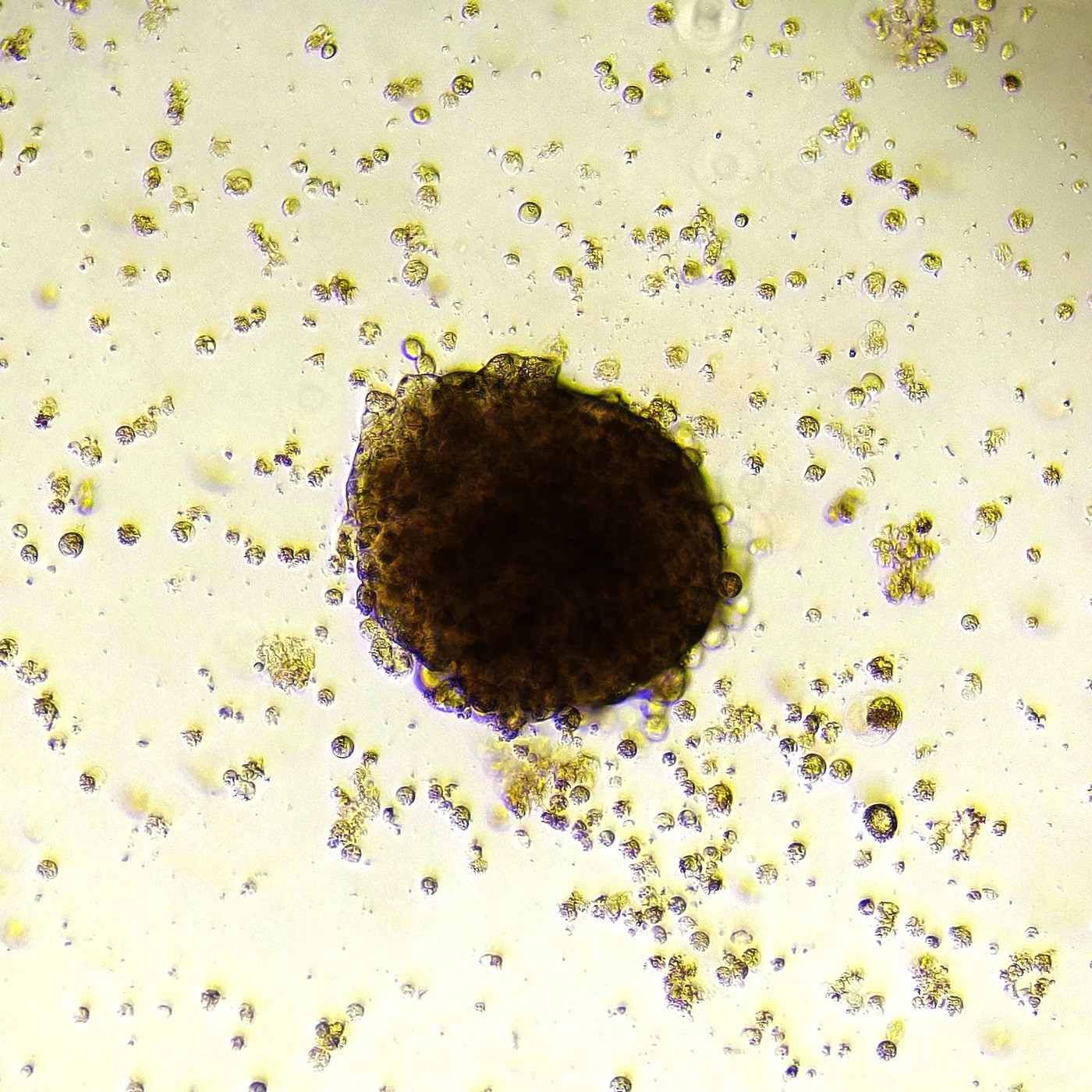 Microscopy image of a colon cancer tumoroid self-organized on TissueTinker's tissue-matched bioink